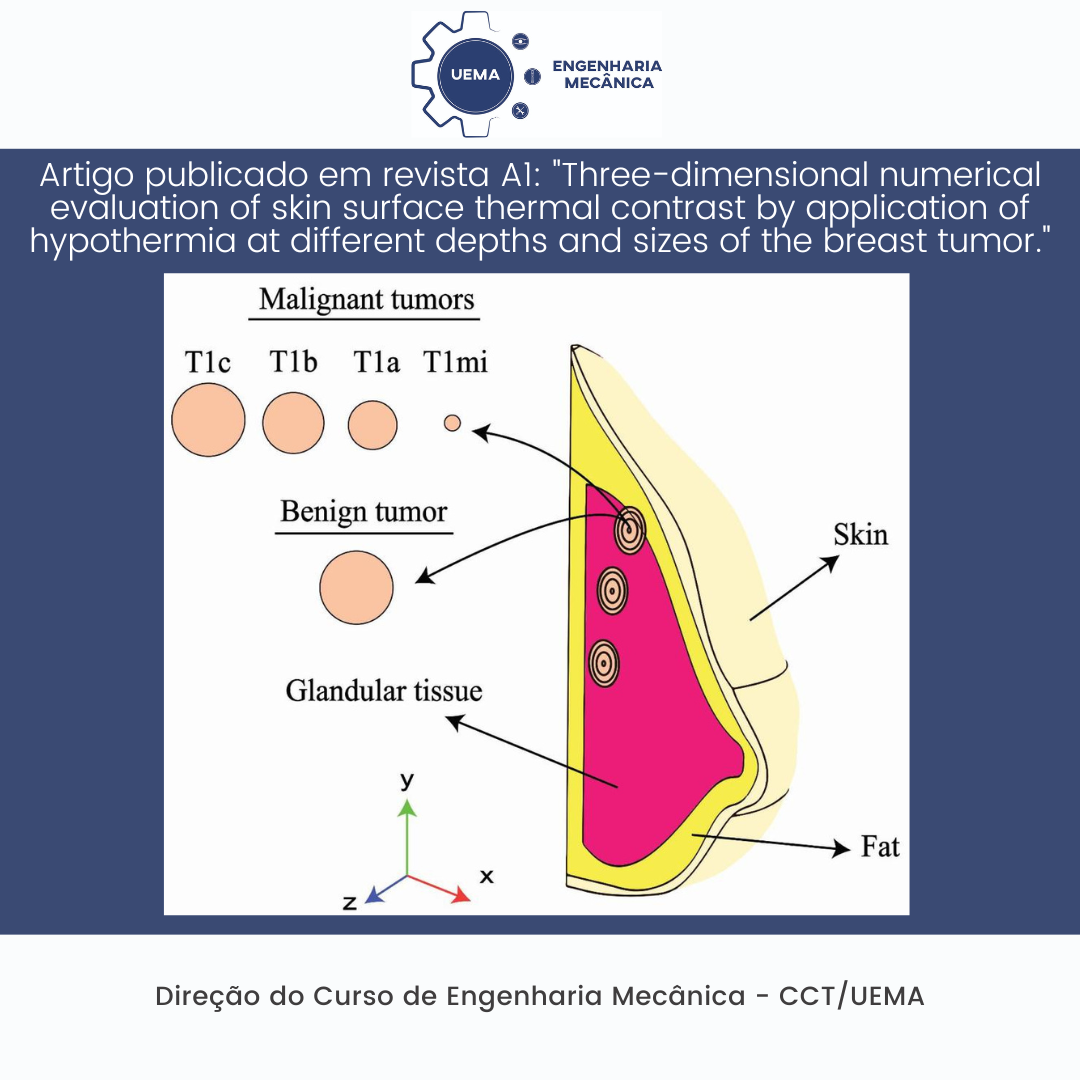 Artigo publicado em revista A1: “Three-dimensional numerical evaluation of skin surface thermal contrast by application of hypothermia at different depths and sizes of the breast tumor.”